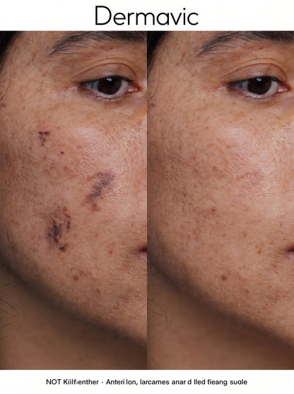 Arbutin 7% + TXA 4% Cream Crema correctora de manchas y paño · Doble activo