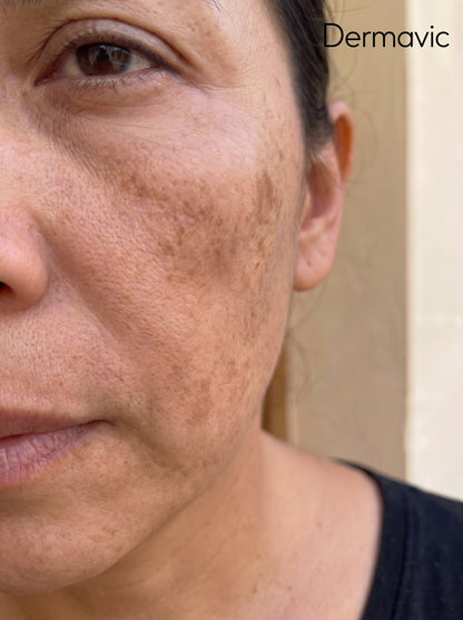 Arbutin 7% + TXA 4% Cream Crema correctora de manchas y paño · Doble activo