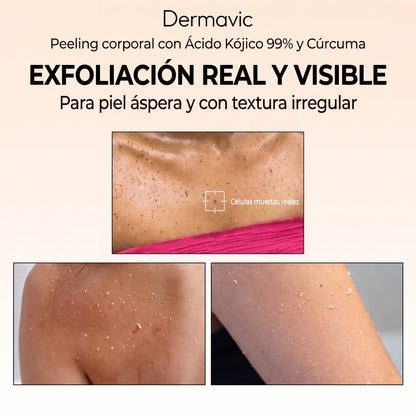 Dermavic Glow Renove — Spray Exfoliante Corporal Ácido Kójico 99% y Cúrcuma 200ml